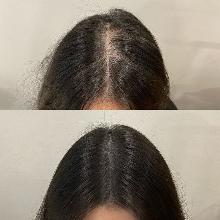 Klarivie Hair Oil Before & After Results